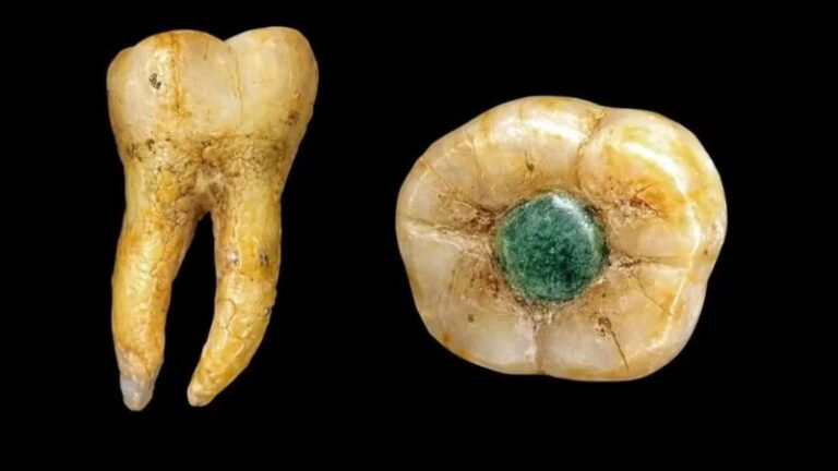 Maias usavam pedras preciosas como “obturações” em dentes