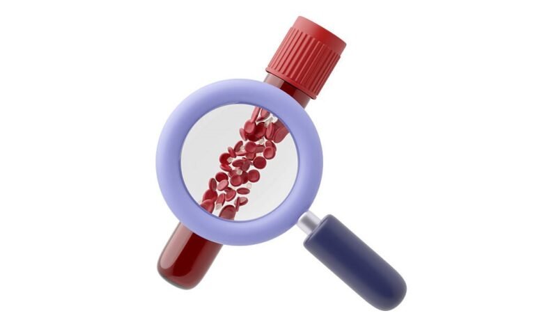 Um tipo sanguíneo parece apresentar risco maior de diabetes tipo 2
